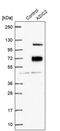 Acid Sensing Ion Channel Subunit 2 antibody, PA5-62554, Invitrogen Antibodies, Western Blot image 