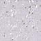 Patched Domain Containing 1 antibody, HPA046110, Atlas Antibodies, Immunohistochemistry frozen image 