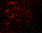 Jumonji Domain Containing 7 antibody, 5385, ProSci, Immunofluorescence image 