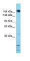 SET Domain Containing 1A, Histone Lysine Methyltransferase antibody, orb324900, Biorbyt, Western Blot image 