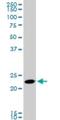 RAB11A, Member RAS Oncogene Family antibody, H00008766-M01, Novus Biologicals, Western Blot image 