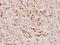 Retinoic Acid Receptor Beta antibody, A01912, Boster Biological Technology, Immunohistochemistry frozen image 