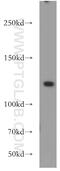 Ubiquitination Factor E4A antibody, 21548-1-AP, Proteintech Group, Western Blot image 