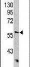 Keratin 10 antibody, PA5-13663, Invitrogen Antibodies, Western Blot image 