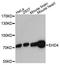 EH Domain Containing 4 antibody, A13766, ABclonal Technology, Western Blot image 