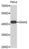 Guanine nucleotide-binding protein G(q) subunit alpha antibody, STJ111488, St John