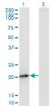 Phosphomevalonate Kinase antibody, H00010654-M07, Novus Biologicals, Western Blot image 