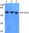 Transcription Factor 4 antibody, A00674S616, Boster Biological Technology, Western Blot image 