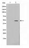Thyroid Hormone Receptor Interactor 13 antibody, TA347670, Origene, Western Blot image 
