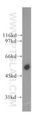 Cytochrome P450 Family 2 Subfamily J Member 2 antibody, 13562-1-AP, Proteintech Group, Western Blot image 