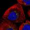 TMEM231 antibody, NBP1-91905, Novus Biologicals, Immunofluorescence image 