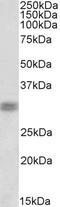 Cone-rod homeobox protein antibody, LS-C204995, Lifespan Biosciences, Western Blot image 