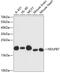 NADH:Ubiquinone Oxidoreductase Subunit B7 antibody, 15-154, ProSci, Western Blot image 