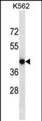 Calcium Voltage-Gated Channel Auxiliary Subunit Gamma 4 antibody, PA5-71761, Invitrogen Antibodies, Western Blot image 