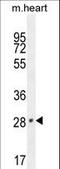 Vestigial Like Family Member 2 antibody, LS-C160524, Lifespan Biosciences, Western Blot image 