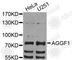 Angiogenic Factor With G-Patch And FHA Domains 1 antibody, A8228, ABclonal Technology, Western Blot image 