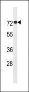 ArfGAP With GTPase Domain, Ankyrin Repeat And PH Domain 11 antibody, PA5-49230, Invitrogen Antibodies, Western Blot image 