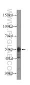 Checkpoint Kinase 1 antibody, 60277-1-Ig, Proteintech Group, Western Blot image 