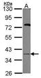 UDP-Galactose-4-Epimerase antibody, PA5-30037, Invitrogen Antibodies, Western Blot image 