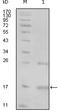 Non-receptor tyrosine-protein kinase TNK1 antibody, M08145, Boster Biological Technology, Western Blot image 