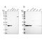 Proteasome Subunit Beta 1 antibody, PA5-56219, Invitrogen Antibodies, Western Blot image 