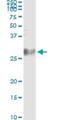 Melanoregulin antibody, H00055686-M01, Novus Biologicals, Immunoprecipitation image 