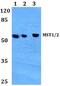 Serine/Threonine Kinase 4 antibody, A00859, Boster Biological Technology, Western Blot image 