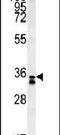 Reticulocalbin 3 antibody, PA5-25688, Invitrogen Antibodies, Western Blot image 