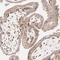 SPARC antibody, NBP1-80972, Novus Biologicals, Immunohistochemistry paraffin image 