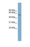 Cytochrome P450 Family 2 Subfamily A Member 7 antibody, NBP1-69676, Novus Biologicals, Western Blot image 