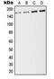 ALK Receptor Tyrosine Kinase antibody, orb216012, Biorbyt, Western Blot image 