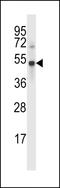 Ubiquitin Specific Peptidase 46 antibody, LS-C160398, Lifespan Biosciences, Western Blot image 