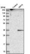 Sirtuin 5 antibody, HPA021798, Atlas Antibodies, Western Blot image 