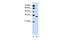 Olfactory Receptor Family 5 Subfamily T Member 2 antibody, GTX47106, GeneTex, Western Blot image 