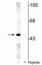 Mitogen-Activated Protein Kinase Kinase 5 antibody, P03980, Boster Biological Technology, Western Blot image 