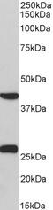 Adrenoceptor Alpha 1B antibody, 43-238, ProSci, Western Blot image 