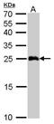 Glutathione S-Transferase Alpha 1 antibody, TA308419, Origene, Western Blot image 