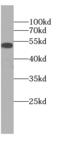 Death-associated protein kinase 3 antibody, FNab09640, FineTest, Western Blot image 