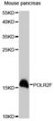 RNA Polymerase II Subunit F antibody, LS-C748232, Lifespan Biosciences, Western Blot image 