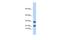 Lipocalin 8 antibody, A14816, Boster Biological Technology, Western Blot image 