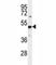 Protein Arginine Methyltransferase 1 antibody, F40435-0.4ML, NSJ Bioreagents, Western Blot image 