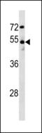 Doublecortin Like Kinase 1 antibody, LS-C203792, Lifespan Biosciences, Western Blot image 