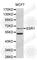 Estrogen Receptor 1 antibody, A3198, ABclonal Technology, Western Blot image 