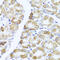 Phosphatidylinositol-4,5-Bisphosphate 3-Kinase Catalytic Subunit Alpha antibody, 14-452, ProSci, Immunohistochemistry frozen image 