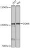Oncostatin M Receptor antibody, GTX33376, GeneTex, Western Blot image 