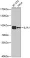 Interleukin 1 Receptor Type 1 antibody, A01092, Boster Biological Technology, Western Blot image 