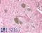Ubiquitin C-Terminal Hydrolase L1 antibody, LS-C142138, Lifespan Biosciences, Immunohistochemistry paraffin image 