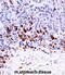 Mitogen-Activated Protein Kinase Kinase Kinase 6 antibody, abx027687, Abbexa, Immunohistochemistry paraffin image 