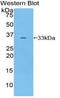 Receptor Tyrosine Kinase Like Orphan Receptor 1 antibody, LS-C296193, Lifespan Biosciences, Western Blot image 