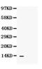 C-X-C Motif Chemokine Ligand 13 antibody, PA5-79105, Invitrogen Antibodies, Western Blot image 